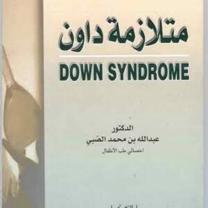 متلازمة داون