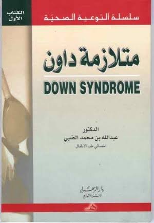 متلازمة داون